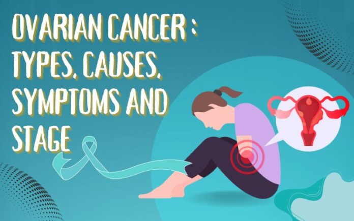 Ovarian Cancer